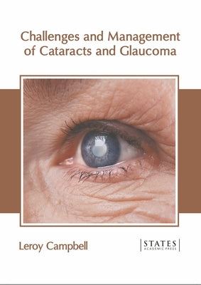 Challenges and Management of Cataracts and Glaucoma by Campbell, Leroy