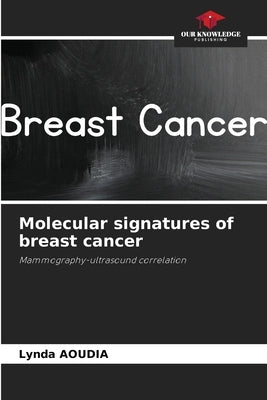 Molecular signatures of breast cancer by Aoudia, Lynda