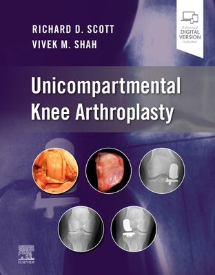 Unicompartmental Knee Arthroplasty by Scott, Richard D.