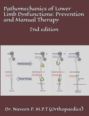 Pathomechanics of Lower Limb Dysfunctions: Prevention and Manual Therapy: 2nd edition by P, Naveen Kumar