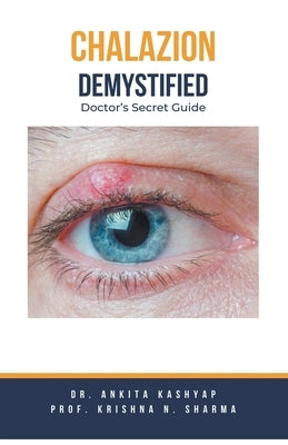 Chalazion Demystified: Doctor's Secret Guide by Kashyap, Ankita