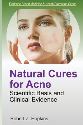 Natural Cures for Acne: Scientific Basis and Clinical Evidence by Hopkins, Robert Z.
