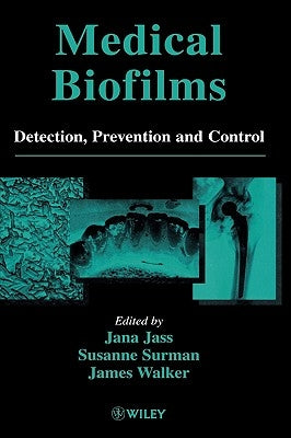 Medical Biofilms: Detection, Prevention and Control by Jass, Jana