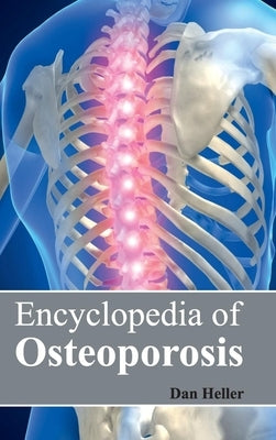Encyclopedia of Osteoporosis by Heller, Dan