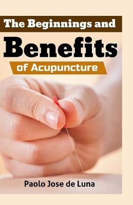 The Beginnings and Benefits of Acupuncture by Jose De Luna, Paolo
