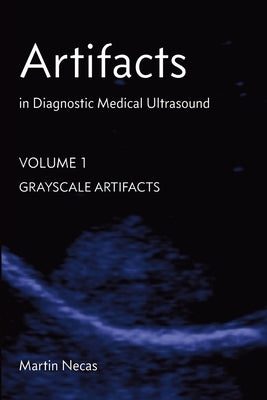 Artifacts in Diagnostic Medical Ultrasound: Grayscale Artifacts by Necas, Martin