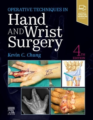 Operative Techniques: Hand and Wrist Surgery by Chung, Kevin C.