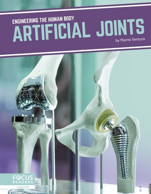 Artificial Joints by Ventura, Marne