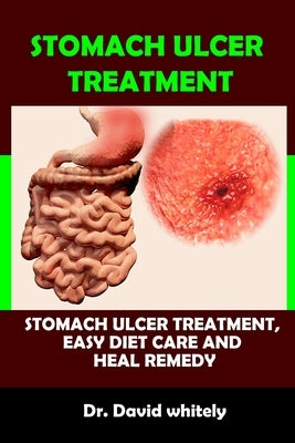 Stomach Ulcer Treatment: Stomach Ulcer Treatment, Easy Diet Care And Heal Remedy by Whitely, David