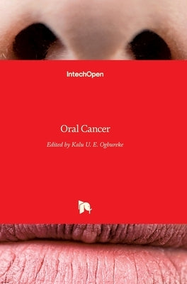 Oral Cancer by Ogbureke, Kalu U. E.