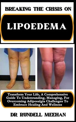 Breaking the Crisis on Lipoedema: Transform Your Life, A Comprehensive Guide To Understanding, Managing, For Overcoming Adiposalgia Challenges To Embr by Meehan, Rundell