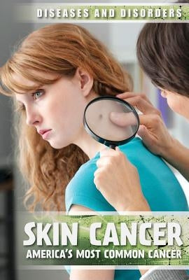 Skin Cancer: America's Most Common Cancer by Kurch, Peter