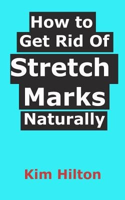 How to Get Rid Of Stretch Marks Naturally by Hilton, Kim