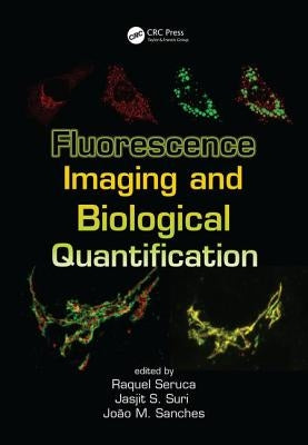 Fluorescence Imaging and Biological Quantification by Seruca, Raquel