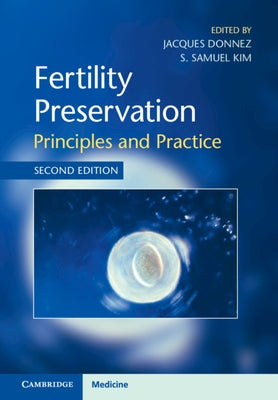 Fertility Preservation: Principles and Practice by Donnez, Jacques