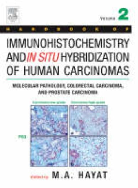 Handbook of Immunohistochemistry and in Situ Hybridization of Human Carcinomas: Molecular Pathology, Colorectal Carcinoma, and Prostate Carcinoma by Hayat, M. A.