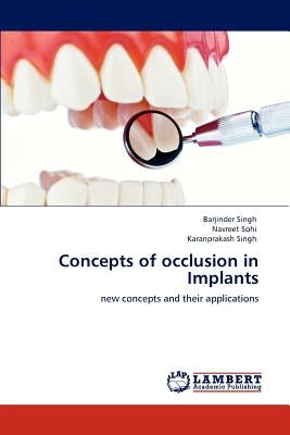 Concepts of occlusion in Implants by Singh, Barjinder