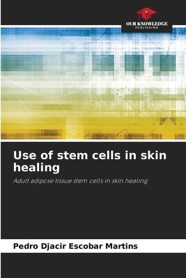 Use of stem cells in skin healing by Escobar Martins, Pedro Djacir
