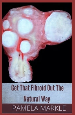 Get That Fibroid Out the Natural Way by Markle, Pamela