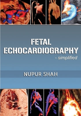 Fetal Echocardiography - Simplified by Shah, Nupur