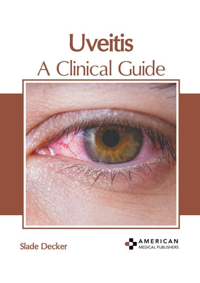 Uveitis: A Clinical Guide by Decker, Slade