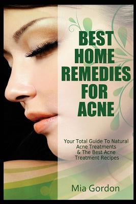 Best Home Remedies For Acne: Your Total Guide To Natural Acne Treatments & The Best Acne Treatment Recipes by Gordon, Mia