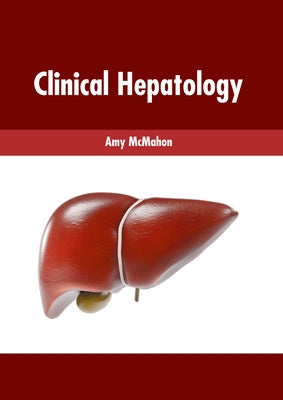 Clinical Hepatology by McMahon, Amy
