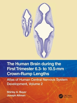 The Human Brain During the First Trimester 6.3- To 10.5-MM Crown-Rump Lengths: Atlas of Human Central Nervous System Development, Volume 2 by Bayer, Shirley A.