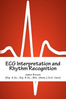 ECG Interpretation and Rhythm Recognition by Fletcher, Peter