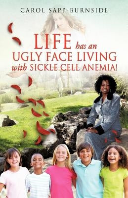 Life Has an Ugly Face Living with Sickle Cell Anemia! by Sapp-Burnside, Carol