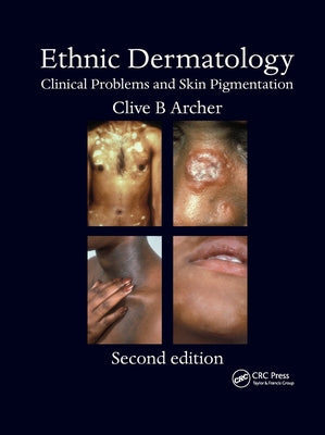 Ethnic Dermatology: Clinical Problems and Skin Pigmentation by Archer, Clive B.