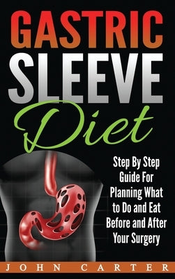 Gastric Sleeve Diet: Step By Step Guide For Planning What to Do and Eat Before and After Your Surgery by Carter, John