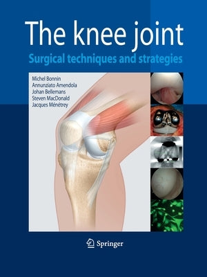 The Knee Joint: Surgical Techniques and Strategies by Bonnin, Michel