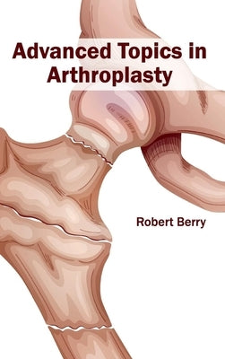 Advanced Topics in Arthroplasty by Berry, Robert