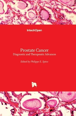Prostate Cancer: Diagnostic and Therapeutic Advances by Spiess, Philippe E.