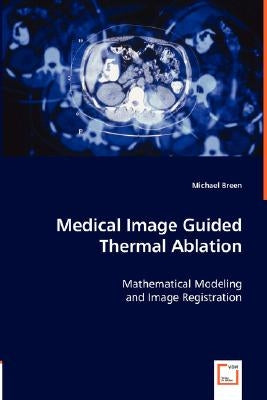 Medical Image Guided Thermal Ablation by Breen, Michael