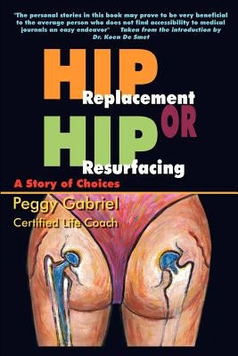 Hip Replacement or Hip Resurfacing: A Story of Choices by Gabriel, Peggy