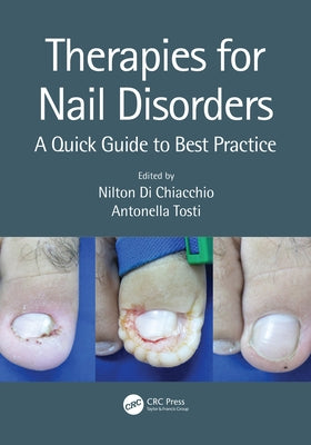 Therapies for Nail Disorders: A Quick Guide to Best Practice by Di Chiacchio, Nilton