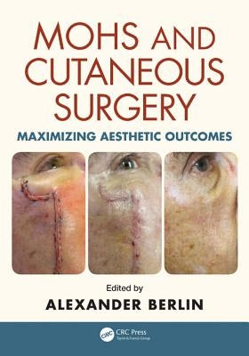 Mohs and Cutaneous Surgery: Maximizing Aesthetic Outcomes by Berlin, Alexander