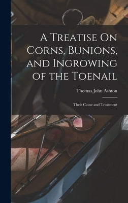 A Treatise On Corns, Bunions, and Ingrowing of the Toenail: Their Cause and Treatment by Ashton, Thomas John