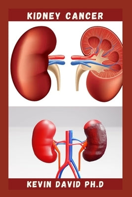 Kidney Cancer: Step By Step Guide On How To Heal Your Kidney And Live Healthily by David Ph. D., Kevin