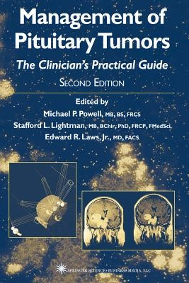 Management of Pituitary Tumors: The Clinician's Practical Guide by Powell, Michael P.