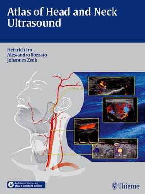 Atlas of Head and Neck Ultrasound by Iro, Heinrich
