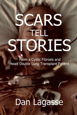 Scars Tell Stories: From a Cystic Fibrosis and Heart/Double Lung Transplant Patient by Lagasse, Doug