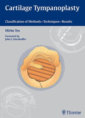 Cartilage Tympanoplasty: Classification of Methods - Techniques - Results by Tos, Mirko