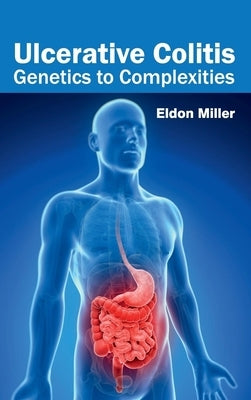 Ulcerative Colitis: Genetics to Complexities by Miller, Eldon
