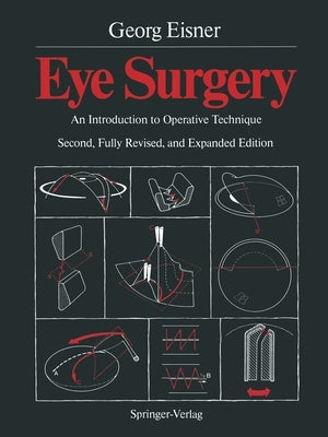Eye Surgery: An Introduction to Operative Technique by Telger, Terry C.