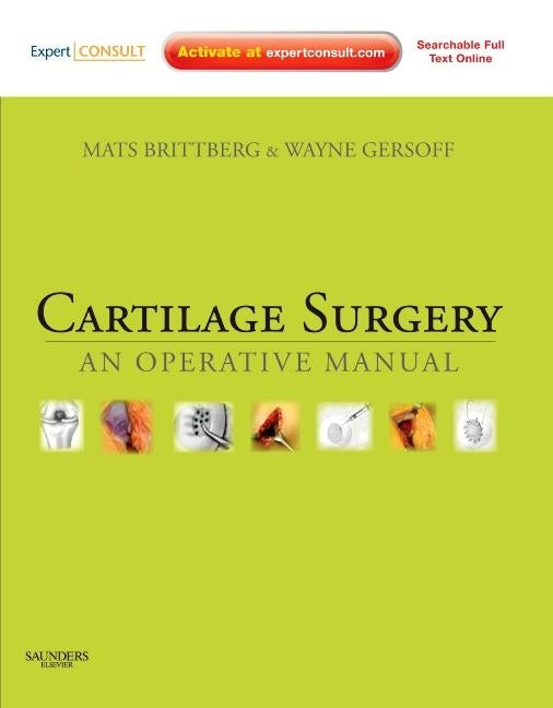 Cartilage Surgery: An Operative Manual, Expert Consult: Online and Print by Brittberg, Mats