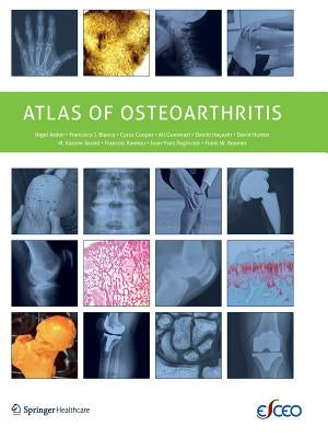 Atlas of Osteoarthritis by Arden, Nigel