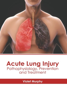 Acute Lung Injury: Pathophysiology, Prevention and Treatment by Murphy, Violet